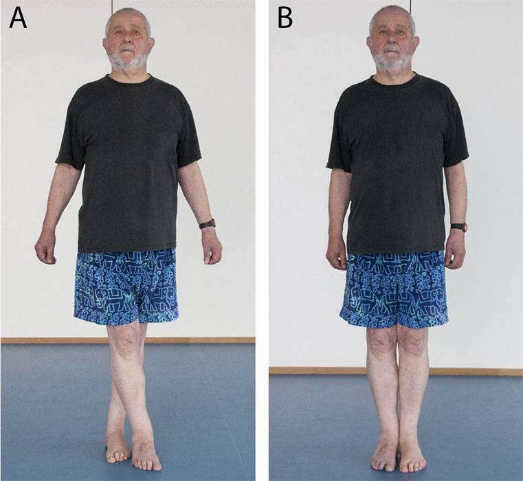 simple-grapevine Simple grapevine