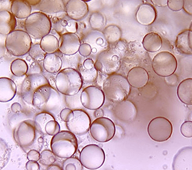 skinny_people_done28099t_have_cellulite-2-380x335-1 4.خرافة : الذين يعانون من النحافة لا يتكون لديهم سلوليت