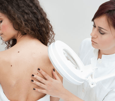 slid_2-1-380x335-1 اذهبي لطبيب جلدية :