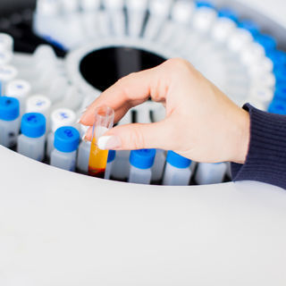 ظهور دم في البول ظهور دم في البول