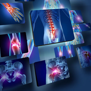 تاثير المرض على العظام تاثير المرض على العظام