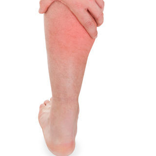 تورم الساقين تورم الساقين