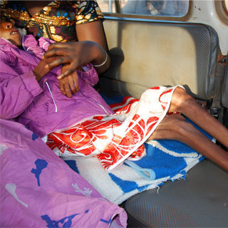 الايدز الايدز