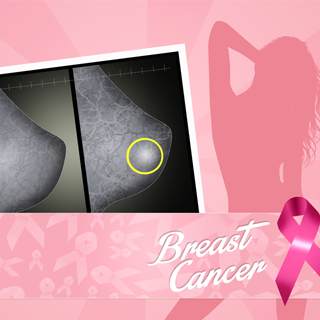 فحص الثدي فحص الثدي