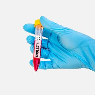 اختبار الكوليسترول اختبار الكوليسترول