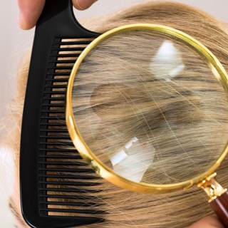 كيفية الكشف عن قمل الرأس كيفية الكشف عن قمل الرأس