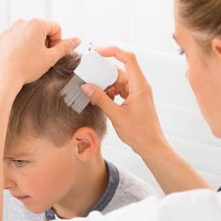 إذا كنت تشك في وجود قمل الرأس إذا كنت تشك في وجود قمل الرأس