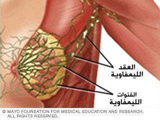 العقد الليمفاوية والقنوات الليمفاوية