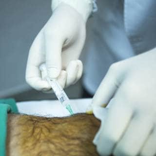 تشخيص النقرس تشخيص النقرس