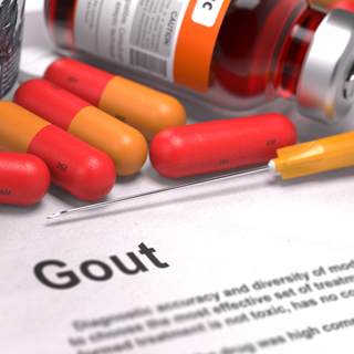 علاج النقرس بالأدوية علاج النقرس بالأدوية