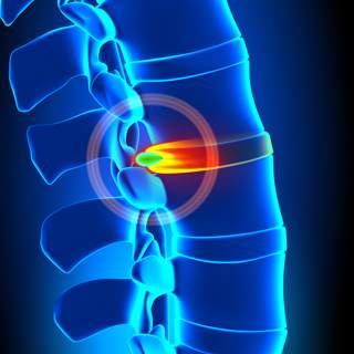 القرص الغضروفي القرص الغضروفي