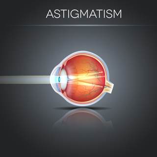 اللابؤرية اللابؤرية