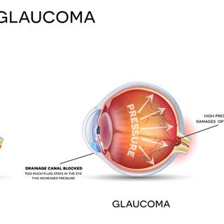 الزرق الزرق
