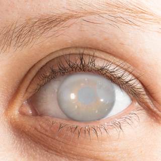 الساد الساد