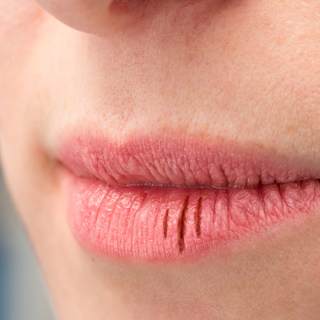 كيف تشعر عند اصابتك بالجفاف كيف تشعر عند اصابتك بالجفاف