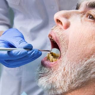 اهمال الاسنان اهمال الاسنان