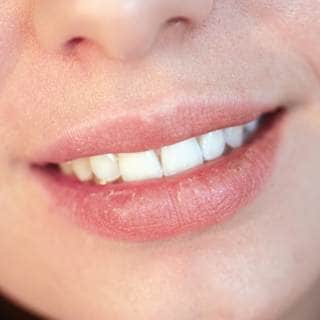 جفاف الفم جفاف الفم