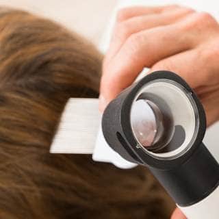 علاج تساقط الشعر علاج تساقط الشعر