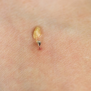 يعالج الجروح يعالج الجروح