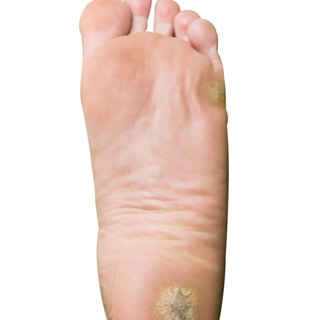 مشاكل القدمين مشاكل القدمين