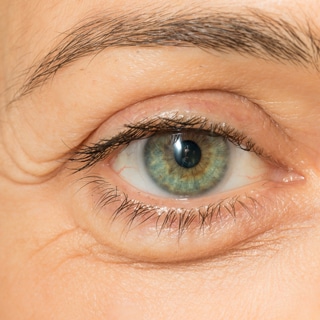 يقلل من انتفاخ العينين يقلل من انتفاخ العينين