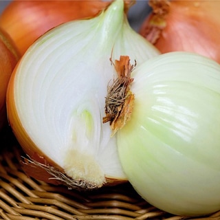 فوائد صحية للبصل فوائد صحية للبصل