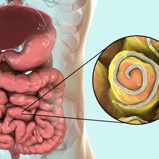 الديدان الديدان