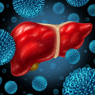 التهاب الكبد E التهاب الكبد E