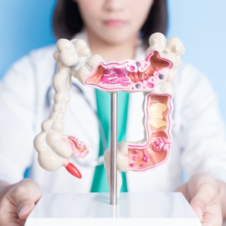 ما هو سرطان القولون والمستقيم؟ ما هو سرطان القولون والمستقيم؟