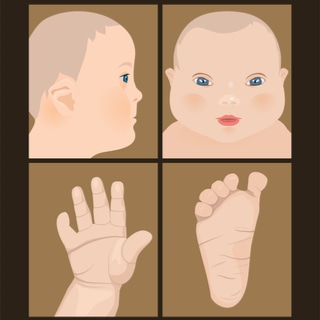 أعراض متلازمة داون ليست نفسها لدى جميع الاشخاص أعراض متلازمة داون ليست نفسها لدى جميع الاشخاص