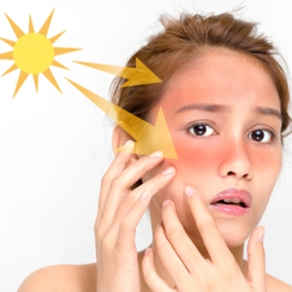 ضربة الشمس ضربة الشمس