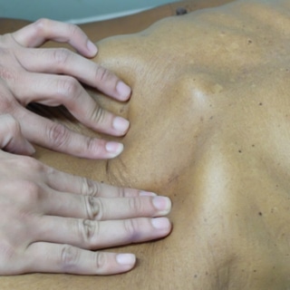 تضخم الكبد تضخم الكبد