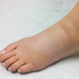 الاستسقاء الاستسقاء