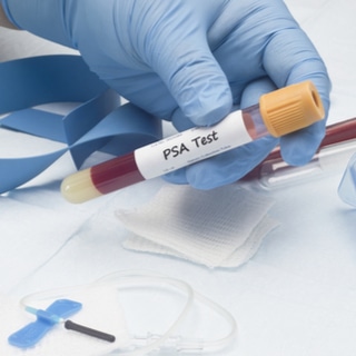 اختبارات لسرطان البروستاتا اختبارات لسرطان البروستاتا