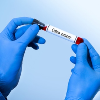 اختبارات سرطان القولون اختبارات سرطان القولون