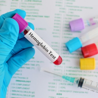 تحفيز إنتاج الهيموغلوبين تحفيز إنتاج الهيموغلوبين