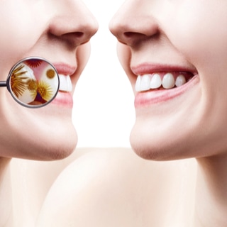 يحسن صحة الفم