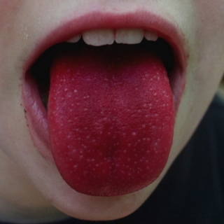 اللسان الاحمر الساطع اللسان الاحمر الساطع