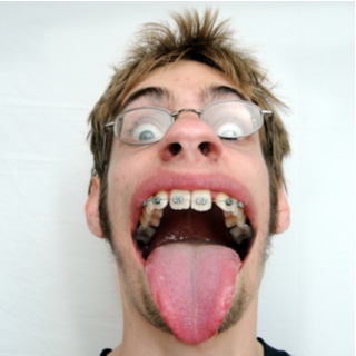 ضخامة اللسان ضخامة اللسان