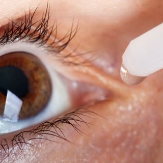 لازالة العدسات ينصح ب لازالة العدسات ينصح ب