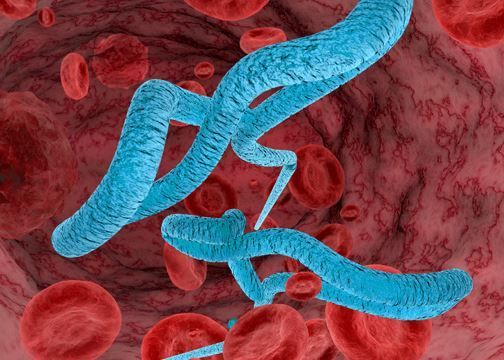 ما هو الايبولا؟ ما هو الايبولا؟