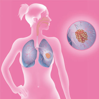 الانتماء الجنسي الانتماء الجنسي