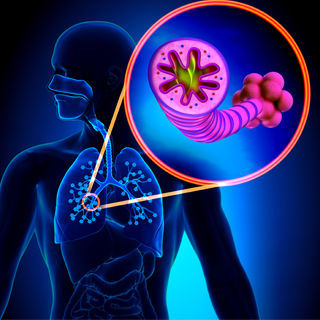 امراض الرئة السابقة امراض الرئة السابقة