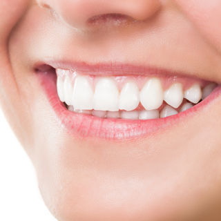 تبيض الاسنان تبيض الاسنان