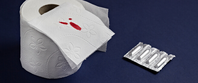 tbl_articles_article_22333_669a4b77799-44da-4f65-ba01-0488474175c8 النزيف الشرجي: أسباب عديدة ومتنوعة