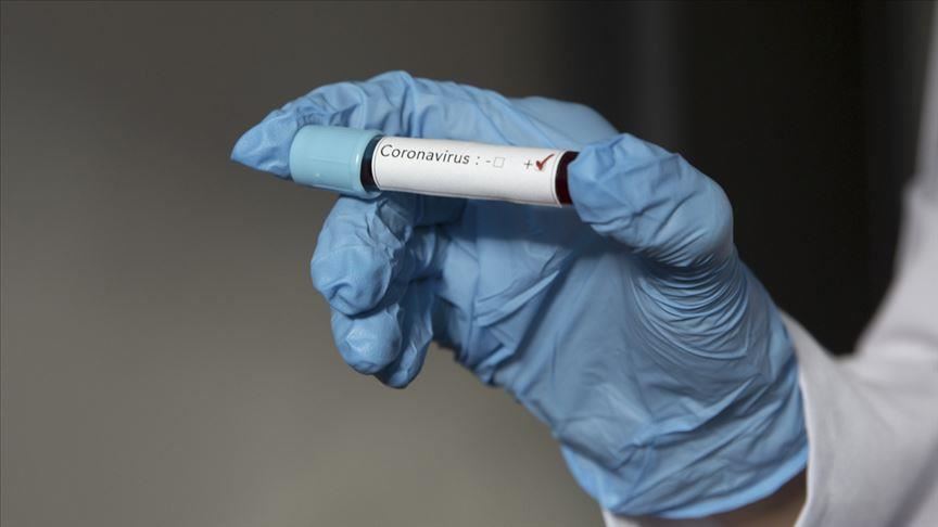 وزير سعودي: "العشرين" تخصص 7 تريليونات دولار لمواجهة "كورونا"