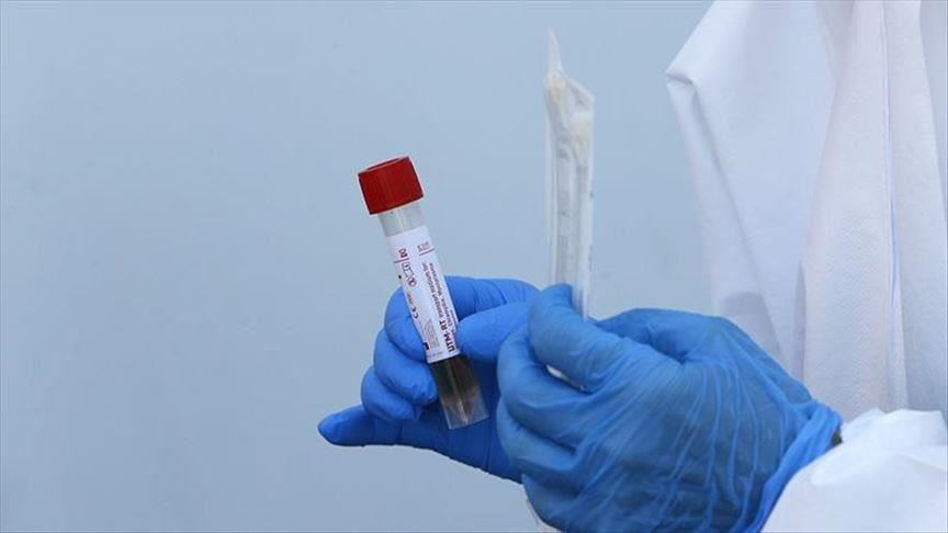 مقدم برنامج "غود مورنييغ أمريكا" يصاب بكورونا