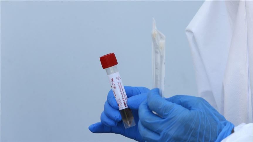 كورونا.. 54 وفاة بين المغتربين الأتراك في هولندا