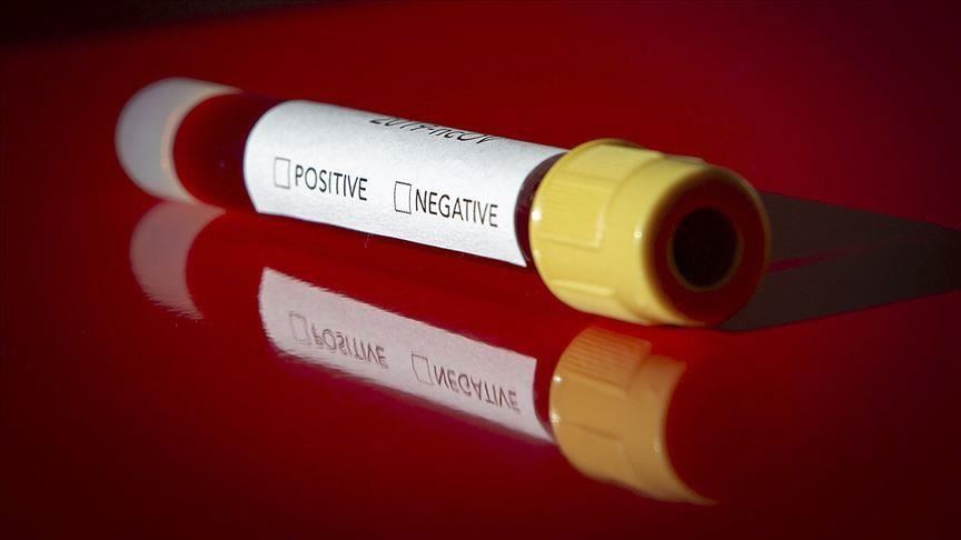 كورونا.. 6 وفيات في السعودية و143 إصابة بالبحرين