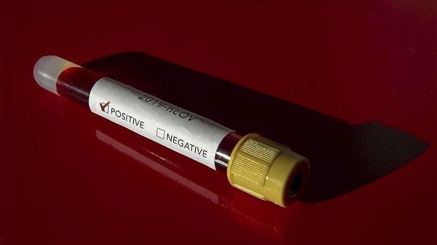 كورونا.. السودان يتسلم إمدادات طبية من رجل أعمال صيني